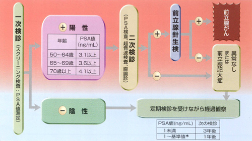 前立腺癌の診断方法